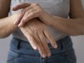 Osteoporose: entenda a doença que fragiliza os ossos e saiba como prevenir