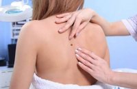 Tocantins acumula mais de 600 casos de câncer de pele em cinco anos